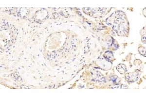 Immunohistochemistry (IHC) image for anti-Lactate Dehydrogenase B (LDHB) (AA 1-334) antibody (ABIN7433966)