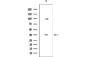 anti-Zinc Finger Protein 771 (ZNF771) (Internal Region) antibody