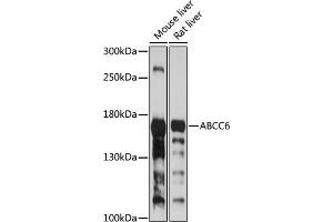 Western blot analysis of extracts of various cell lines, using  antibody (ABIN6134206, ABIN6136365, ABIN6136366 and ABIN6224126) at 1:1000 dilution. (ABCC6 antibody  (AA 830-940))