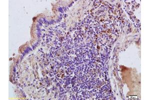 Formalin-fixed and paraffin embedded rat lung labeled with Anti-RHEB Polyclonal Antibody, Unconjugated (ABIN704771) at 1:200 followed by conjugation to the secondary antibody and DAB staining. (RHEB antibody  (AA 101-184))