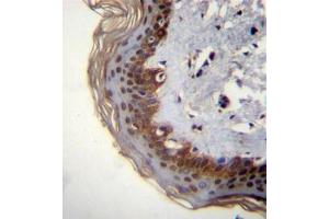 Formalin fixed, paraffin embedded human skin tissue stained with RBM42 Antibody (C-term) followed by peroxidase conjugation of the secondary antibody and DAB staining. (RBM42 antibody  (C-Term))