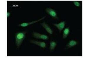 Immunostaining analysis in HeLa cells. (LSM10 antibody)