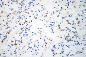 Immunohistochemistry was performed on paraffin-embedded mouse lung using phospho-ACC(S79) antibody (ABIN7797443), 1:200).
