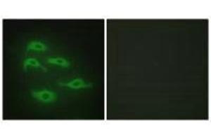 Immunofluorescence analysis of HepG2 cells, using SERC3 antibody. (SERINC3 antibody  (C-Term))
