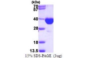 SDS-PAGE (SDS) image for Peroxisomal Trans-2-Enoyl-CoA Reductase (PECR) (AA 1-303) protein (His tag) (ABIN667579) (PECR Protein (AA 1-303) (His tag))
