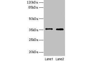 Western blot All lanes: FOXR2 antibody at 4 μg/mL Lane 1: SH-SY5Y whole cell lysate Lane 2: Hela whole cell lysate Secondary Goat polyclonal to rabbit IgG at 1/10000 dilution Predicted band size: 36 kDa Observed band size: 36 kDa (FOXR2 antibody  (AA 1-300))