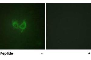 Immunofluorescence analysis of HUVEC cells, using MARK2 polyclonal antibody . (MARK2 antibody)