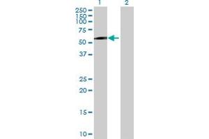Western Blot analysis of MAGEC2 expression in transfected 293T cell line by MAGEC2 MaxPab polyclonal antibody. (MAGEC2 antibody  (AA 1-373))