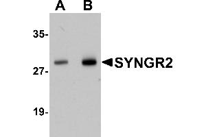 Western Blotting (WB) image for anti-Synaptogyrin 2 (SYNGR2) (N-Term) antibody (ABIN1031591) (SYNGR2 antibody  (N-Term))