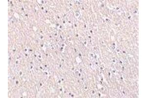 Immunohistochemical staining of CIDE-A in human brain tissue with CIDE-A antibody at 5μg/ml. (CIDEA antibody  (AA 200-217))