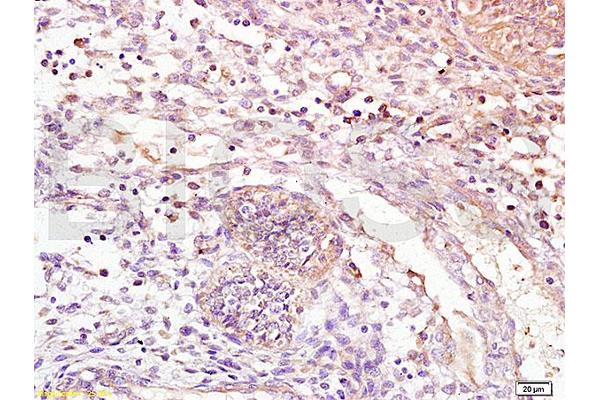 Leukotriene B4 Receptor/BLT antibody  (AA 101-200)