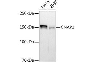 Western blot analysis of extracts of various cell lines, using (ABIN7268948) at 1:1000 dilution. (NCAPD2 antibody)