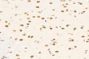 Immunohistochemistry analysis of paraffin-embedded mouse brain using,SMAD9 (ABIN7075625) at dilution of 1: 800