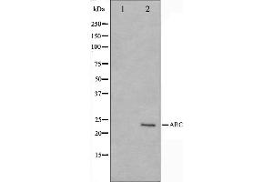 Western blot analysis on HeLa cell lysate using ARC Antibody,The lane on the left is treated with the antigen-specific peptide. (NOL3 antibody  (C-Term))