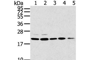 Western Blot analysis of 293T, 231, PC3, A549 and K562 cell using TPD52L1 Polyclonal Antibody at dilution of 1:300 (TPD52L1 antibody)