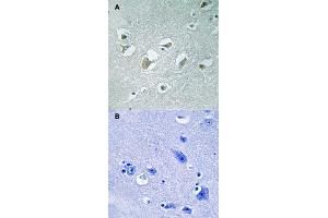 Immunohistochemical staining of human brain tissue by MAP3K9/MAP3K10 (phospho T312/266) polyclonal antibody  without blocking peptide (A) or preincubated with blocking peptide (B) under 1:50-1:100 dilution. (MAP3K9 antibody  (pThr266, pThr312))