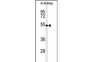 Western blot analysis of PCB Antibody (N-term) (ABIN651181 and ABIN2840115) in mouse kidney tissue lysates (35 μg/lane). (PMPCB antibody  (N-Term))