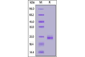 Human KRAS, His Tag on  under reducing (R) condition. (K-RAS Protein (AA 1-169) (His tag))