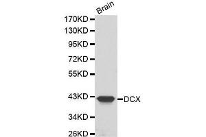 Western Blotting (WB) image for anti-Doublecortin (DCX) (AA 11-360) antibody (ABIN3021510) (Doublecortin antibody  (AA 11-360))
