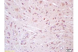 Formalin-fixed and paraffin embedded rat spinal cord tissue labeled with Rabbit Anti TRPV4/TRP12 Polyclonal Antibody, Unconjugated (ABIN873245) at 1:200 followed by conjugation to the secondary antibody and DAB staining (TRPV4 antibody  (AA 301-400))