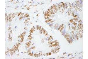 Immunohistochemistry (IHC) image for anti-Splicing Factor Proline/glutamine-Ric (SFPQ) (AA 657-707) antibody (ABIN7449003) (SFPQ antibody  (AA 657-707))