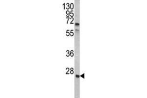 Western blot analysis of GRB2 antibody and A2058 lysate. (GRB2 antibody  (AA 89-118))