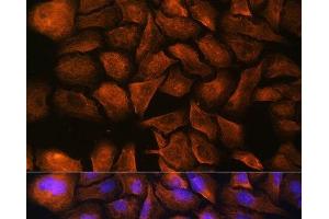 Immunofluorescence analysis of U-2 OS cells using SPTAN1 Polyclonal Antibody at dilution of 1:100. (SPTAN1 antibody)