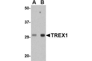 Western blot analysis of TREX1 in human spleen tissue lysate with this product at (A) 0. (TREX1 antibody  (Center))