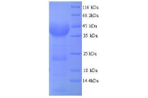 Malic Enzyme Complex, Mitochondrial (Mod2) (AA 1084-1419) protein (His tag)