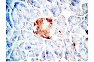 Human pancreas cancer tissue was stained by Rabbit Anti-Oxyntomodulin (H,M,R) Antibody (OXM antibody)