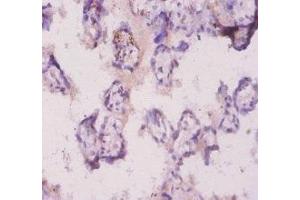 Immunohistochemistry of paraffin-embedded human placenta tissue using ABIN7176944 at dilution of 1:20 (Angiopoietin 2 antibody  (AA 19-483))