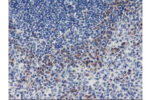 Immunohistochemical staining of paraffin-embedded Human tonsil using anti-ALG2 mouse monoclonal antibody.