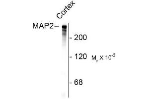 Image no. 1 for anti-Microtubule-Associated Protein 2 (MAP2) antibody (ABIN372661) (MAP2 antibody)