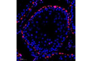Immunofluorescence of paraffin embedded rat testis using MED17 (ABIN7074579) at dilution of 1:600 (300x lens)