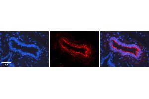 Rabbit Anti-NOTCH1 Antibody   Formalin Fixed Paraffin Embedded Tissue: Human Lung Tissue Observed Staining: Plasma membrane Primary Antibody Concentration: 1:100 Other Working Concentrations: 1:600 Secondary Antibody: Donkey anti-Rabbit-Cy3 Secondary Antibody Concentration: 1:200 Magnification: 20X Exposure Time: 0. (Notch1 antibody  (Middle Region))