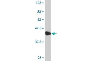Western Blot detection against Immunogen (37. (EVX1 antibody  (AA 2-110))