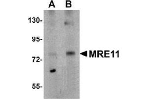 Western blot analysis of MRE11 in rat lung tissue lysate with MRE11 Antibody  at (A) 1 and (B) 2 μg/ml. (Mre11 antibody  (N-Term))