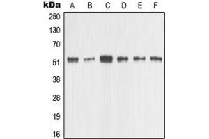 Western blot analysis of MMP1 expression in HeLa (A), MCF7 (B), MDAMB435 (C), Raw264. (MMP1 antibody  (C-Term))