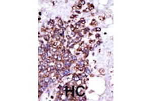 Immunohistochemistry (IHC) image for anti-Calcium/calmodulin-Dependent Protein Kinase I (CAMK1) antibody (ABIN3003045) (CAMK1 antibody)