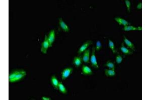 Immunofluorescent analysis of Hela cells using ABIN7169270 at dilution of 1:100 and Alexa Fluor 488-congugated AffiniPure Goat Anti-Rabbit IgG(H+L)