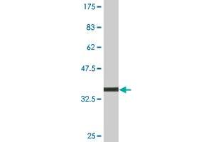 Western Blot detection against Immunogen (35. (MDH1 antibody  (AA 101-193))
