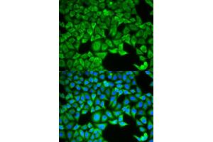 Immunofluorescence (IF) image for anti-Solute Carrier Family 3 Member 1 (SLC3A1) antibody (ABIN1876686)
