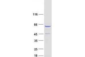 Validation with Western Blot