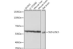 Western blot analysis of extracts of various cell lines, using DLDH/DLD Rabbit mAb (ABIN7266766) at 1:3000 dilution. (DLD antibody)