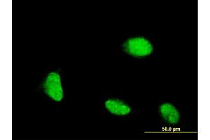 Immunofluorescence of monoclonal antibody to CSRP1 on HeLa cell. (CSRP1 antibody  (AA 94-192))