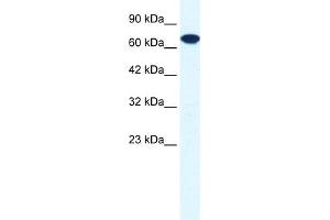 WB Suggested Anti-ZNF179 Antibody Titration:  0. (RNF112 antibody  (C-Term))
