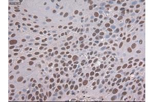 Immunohistochemistry (IHC) image for anti-Notch 1 (NOTCH1) (AA 2300-2556) antibody (ABIN1491242)
