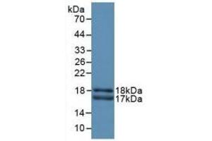 Detection of Recombinant CEACAM1, Rat using Polyclonal Antibody to Carcinoembryonic Antigen Related Cell Adhesion Molecule 1 (CEACAM1) (CEACAM1 antibody  (AA 36-145))