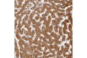 Immunohistochemical staining of human liver with MAGEB17 polyclonal antibody  shows strong cytoplasmic positivity in hepatocyte at 1:50-1:200 dilution. (MAGEB17 antibody)