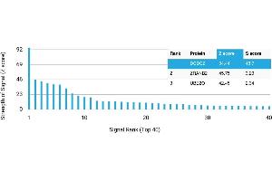 Protein Array (PAr) image for anti-Doublecortin Domain Containing 2 (DCDC2) antibody (ABIN7456335) (DCDC2 antibody)